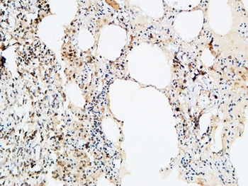 VEGF-D rabbit pAb Antibody
