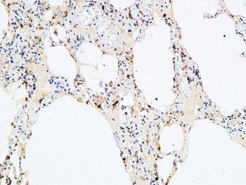 VEGF-D rabbit pAb Antibody