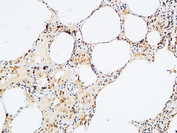 VEGF-D rabbit pAb Antibody