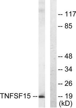 VEGI rabbit pAb Antibody