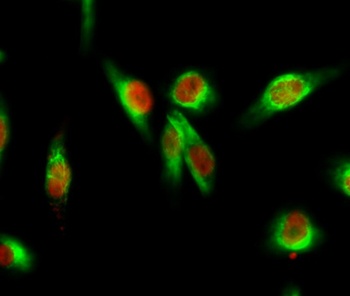 YAP rabbit pAb Antibody