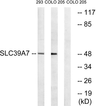 ZIP7 rabbit pAb Antibody