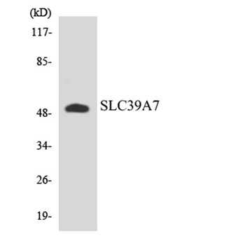 ZIP7 rabbit pAb Antibody