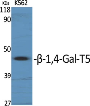 β-1,4-Gal-T5 rabbit pAb Antibody