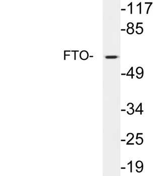 FTO rabbit pAb Antibody