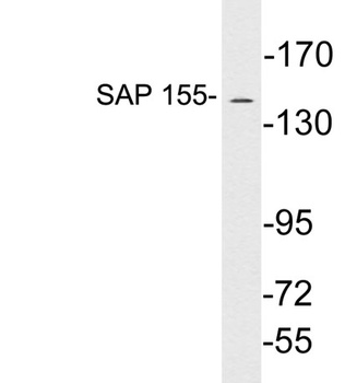 SAP 155 rabbit pAb Antibody