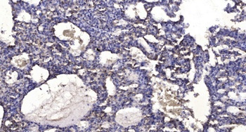SAP 155 rabbit pAb Antibody