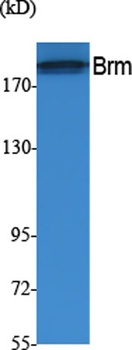 Brm rabbit pAb Antibody
