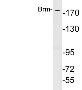 Brm rabbit pAb Antibody