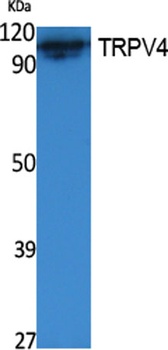 TRPV4 rabbit pAb Antibody