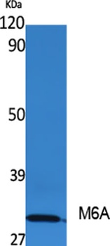 M6A rabbit pAb Antibody