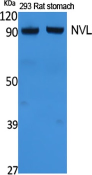 NVL rabbit pAb Antibody