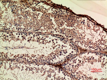 APLP-1 rabbit pAb Antibody