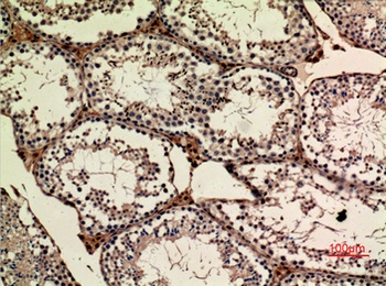 APLP-1 rabbit pAb Antibody