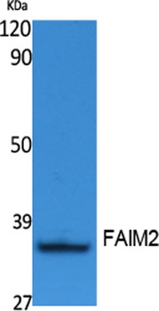 FAIM2 rabbit pAb Antibody