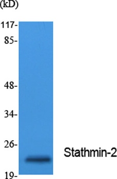 Stathmin-2 rabbit pAb Antibody
