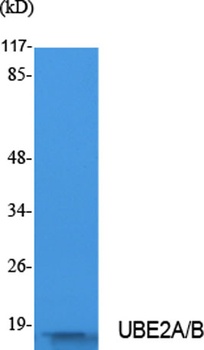 UBE2A/B rabbit pAb Antibody