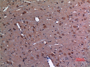UBE2A/B rabbit pAb Antibody