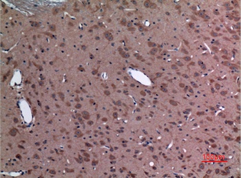 UBE2A/B rabbit pAb Antibody