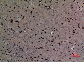 UBE2A/B rabbit pAb Antibody