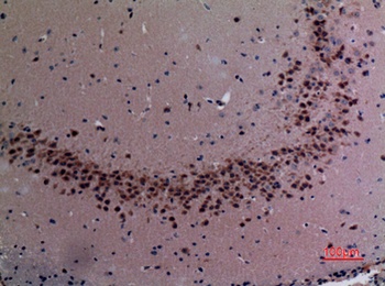 TudorSN rabbit pAb Antibody