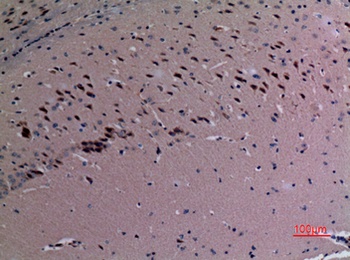 TudorSN rabbit pAb Antibody