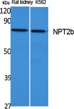 NPT2b rabbit pAb Antibody