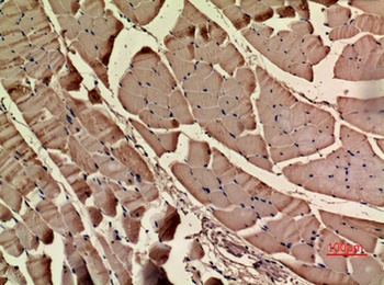 Actin-α cardiac muscle rabbit pAb Antibody