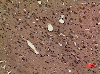 Fractalkine Receptor rabbit pAb Antibody