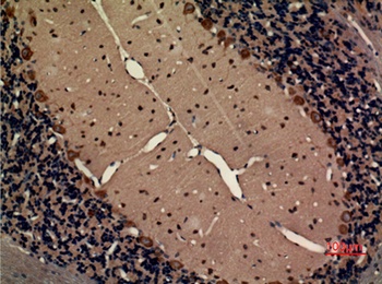 Fractalkine Receptor rabbit pAb Antibody