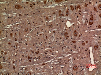 Fractalkine Receptor rabbit pAb Antibody