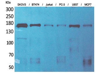 SCP-2 rabbit pAb Antibody