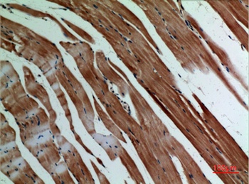 α-SMA rabbit pAb Antibody