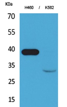 Cathepsin L rabbit pAb Antibody
