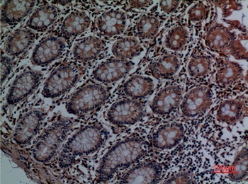 Cathepsin L rabbit pAb Antibody