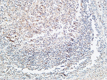 Prothrombin rabbit pAb Antibody