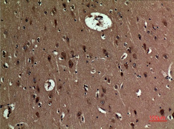 BNIP-3 rabbit pAb Antibody