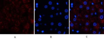 Catalase rabbit pAb Antibody