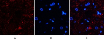 Catalase rabbit pAb Antibody