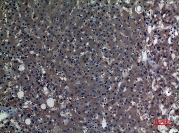 ALDH1A1 rabbit pAb Antibody