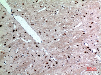 Cytokeratin 14 rabbit pAb Antibody