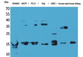 MK rabbit pAb Antibody