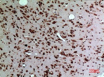 MK rabbit pAb Antibody