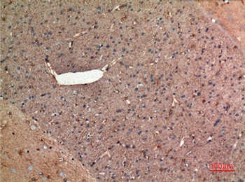 Aldolase C rabbit pAb Antibody
