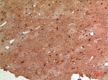 Aldolase C rabbit pAb Antibody