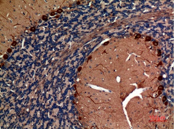 Aldolase C rabbit pAb Antibody