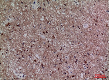 Cdc34 rabbit pAb Antibody