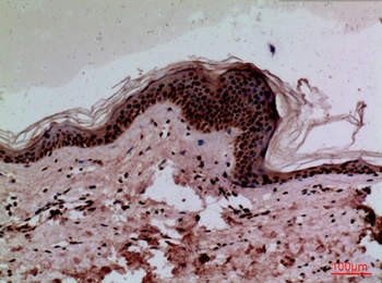 CEACAM1/5 rabbit pAb Antibody