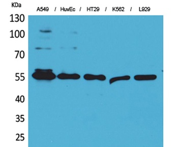 Fascin 1 rabbit pAb Antibody
