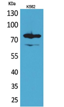 FOXP1 rabbit pAb Antibody